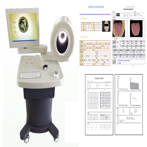 中醫(yī)舌面檢測(cè)分析系統(tǒng)